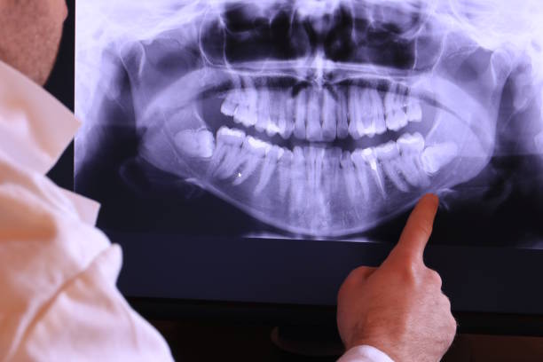 Tooth Infection Emergency Dentist in NH
